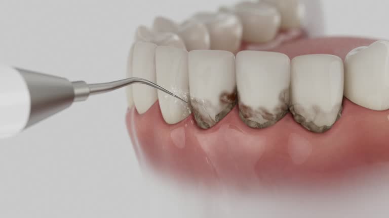 Trusted Tooth Extraction service in Raymore, MO - Dentist Open Now